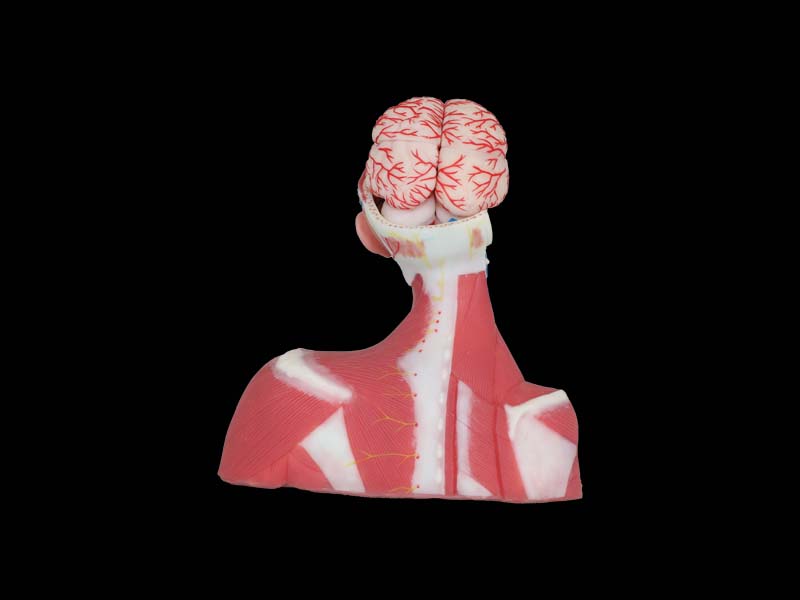 Superior Vena Cava Reflux Soft Anatomy Model