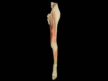 plastination nerves of lower limb