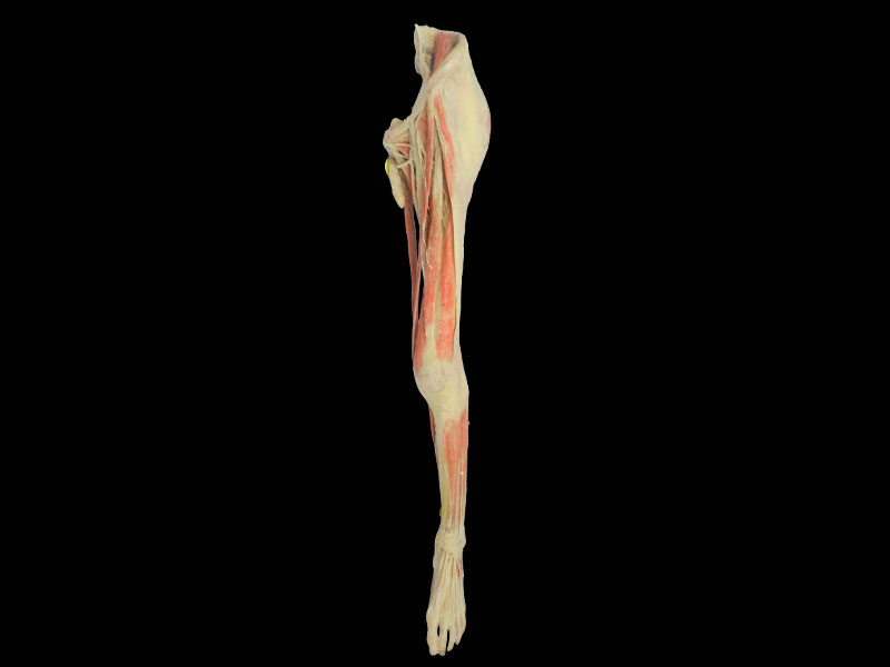 Plastinated nerves of lower limb