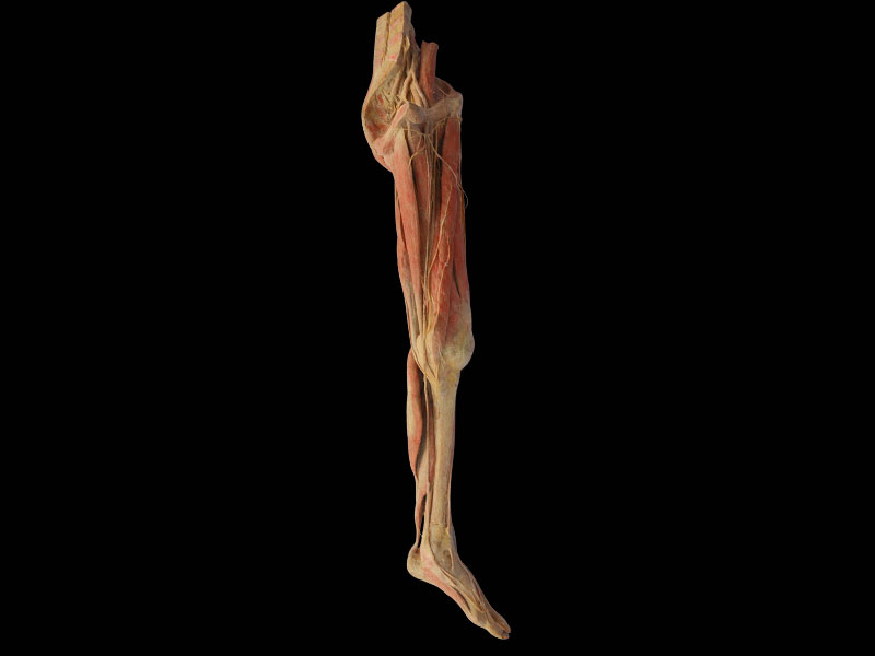 Superficial blood vessles and nerves of lower limb plastination
