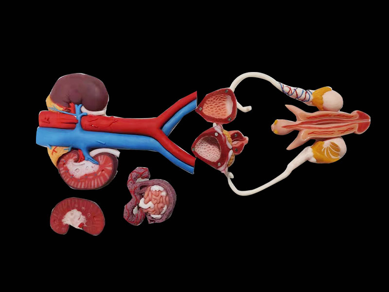 Male Genitourinary System Silicone Anatomy Model