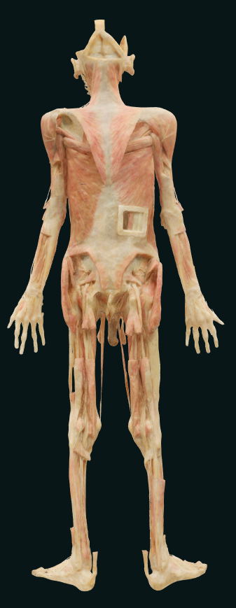vascular nerves of whole body plastination specimen