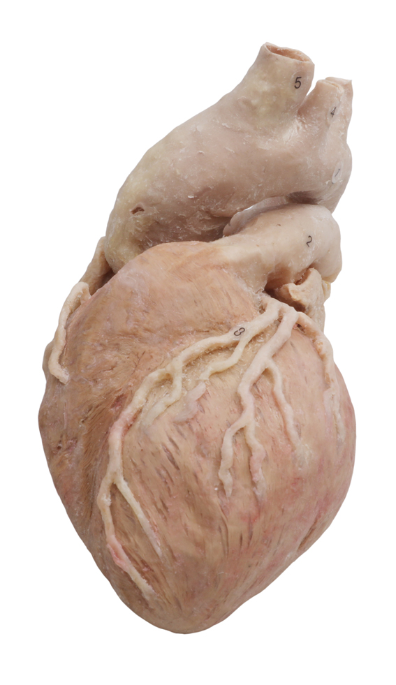 plastinated human heart