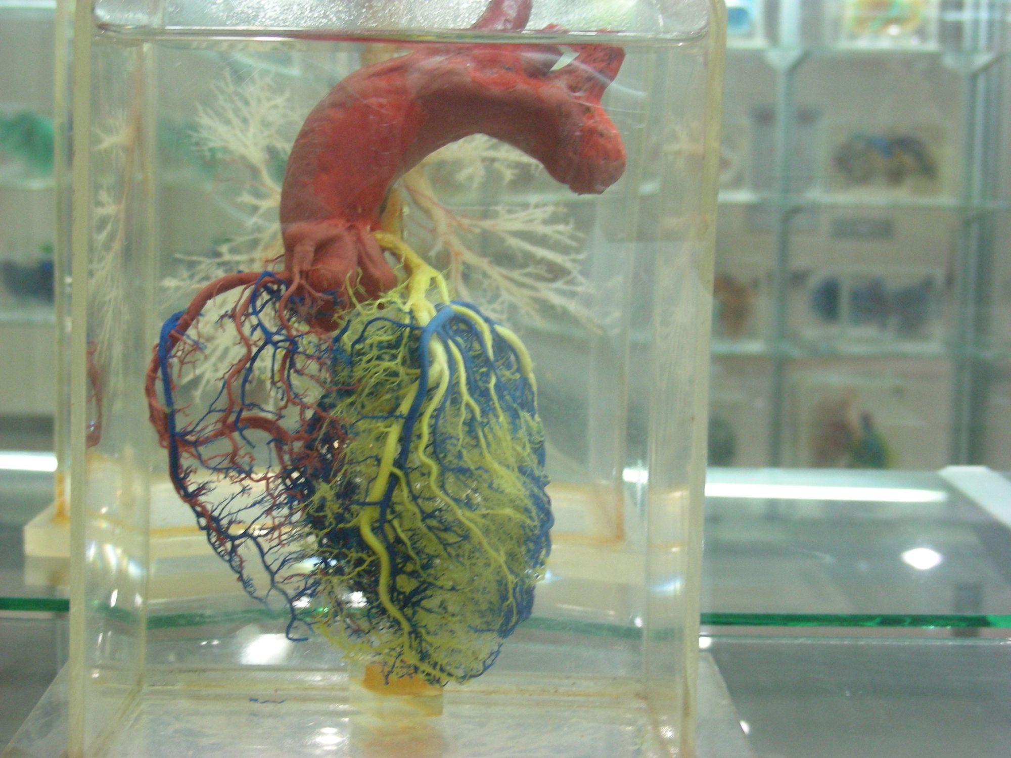 heart casting specimen