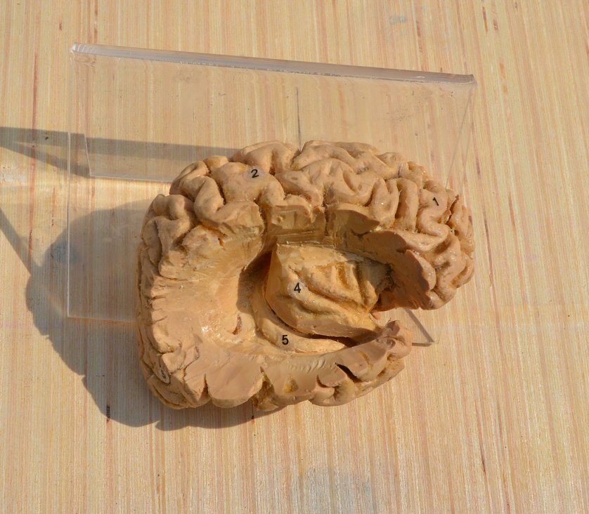 hippocampal formation of brain plastination specimen