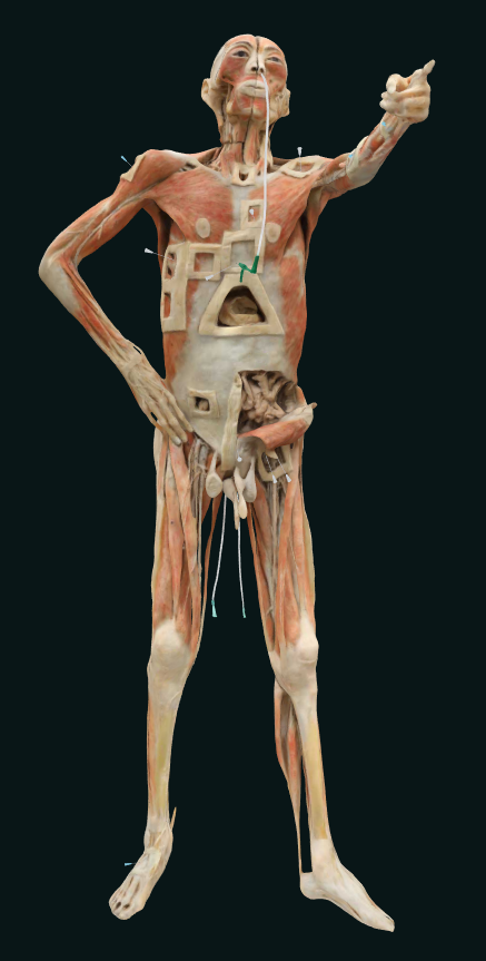 nursing plastianted human body