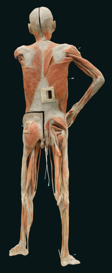 nursing plastianted body