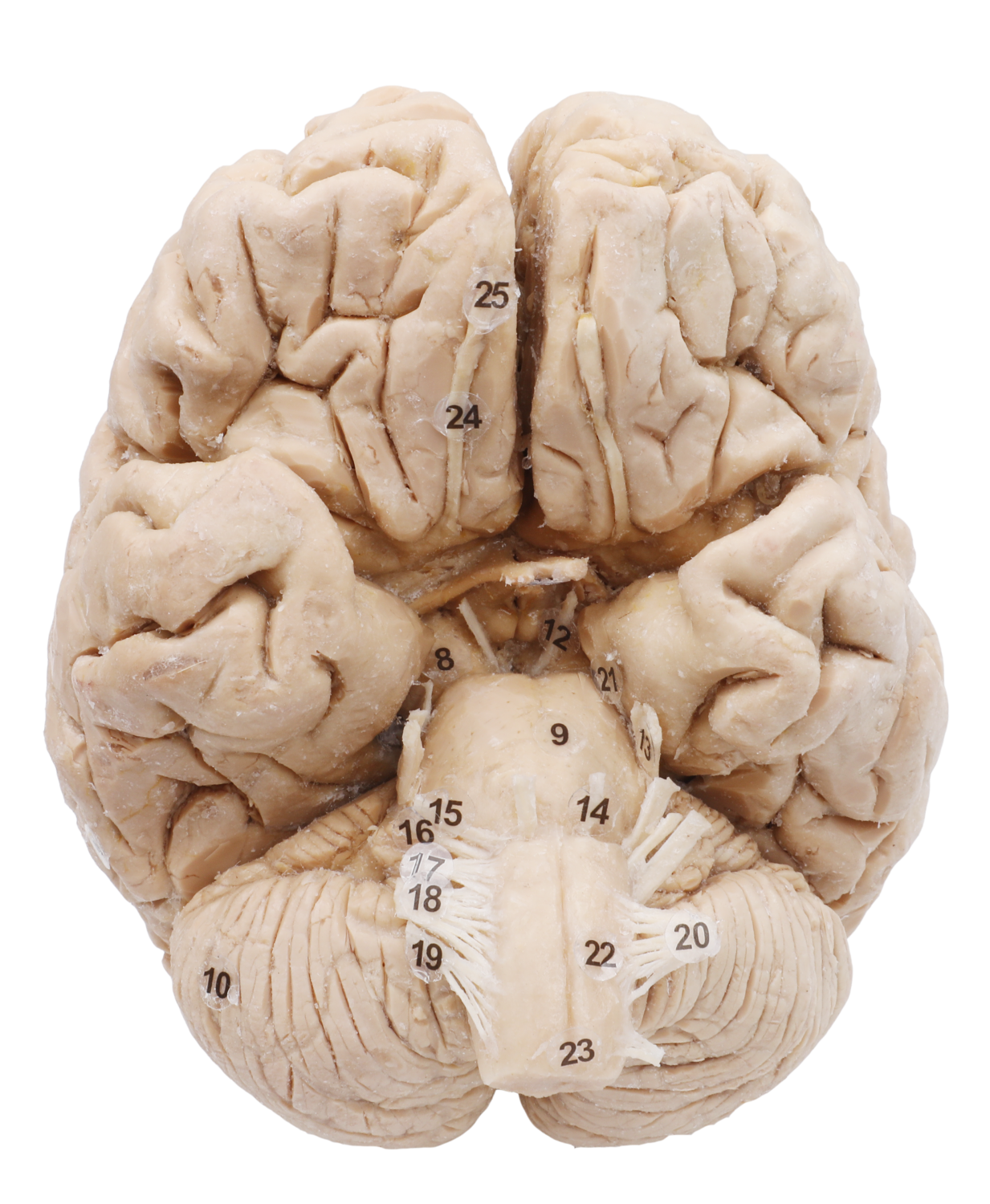 plastinated brain