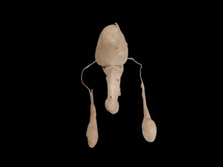 Male Genital Organ Plastinated Specimen