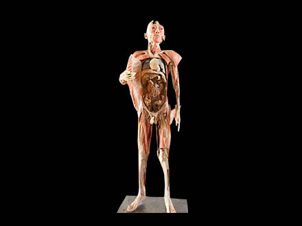 Human Body Plastination