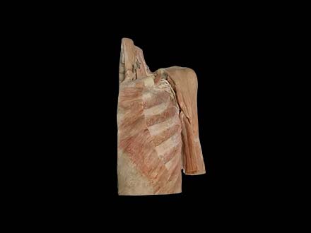 Subclavian Artery and Its Branches Plastination