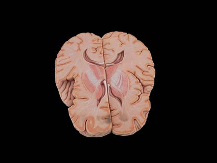 Simulation Cross Section Brain Model