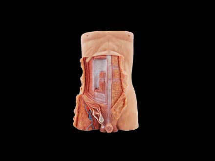 Anterior Abdominal Wall and Inguinal Hernia Anatomy Model