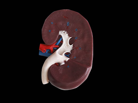 Section of Kidney Soft Silicone Anatomy Model