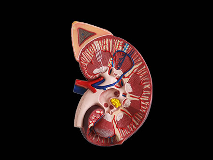 Kidney with Adrenal Gland Soft Silicone Anatomy Model