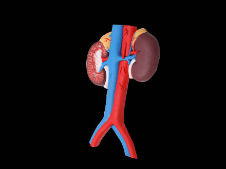 Human Renal Blood Vessels Soft Silicone Anatomy Model for sale