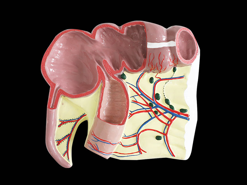 Ileocecal Junction Soft Silicone Anatomy Model