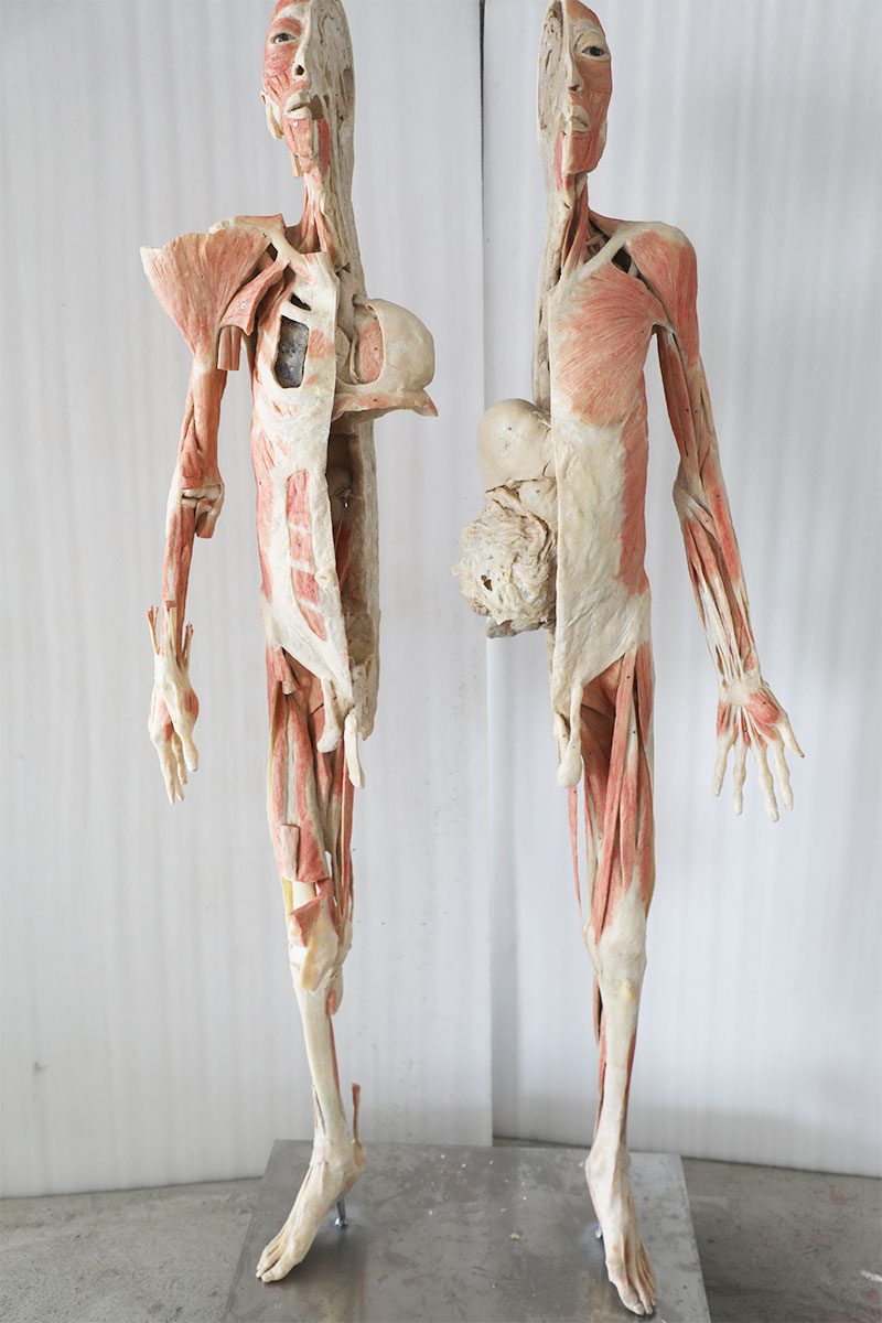 plastinated human body