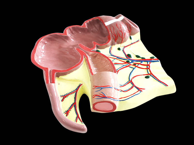 Ileocecal Junction Silicone Anatomy Model