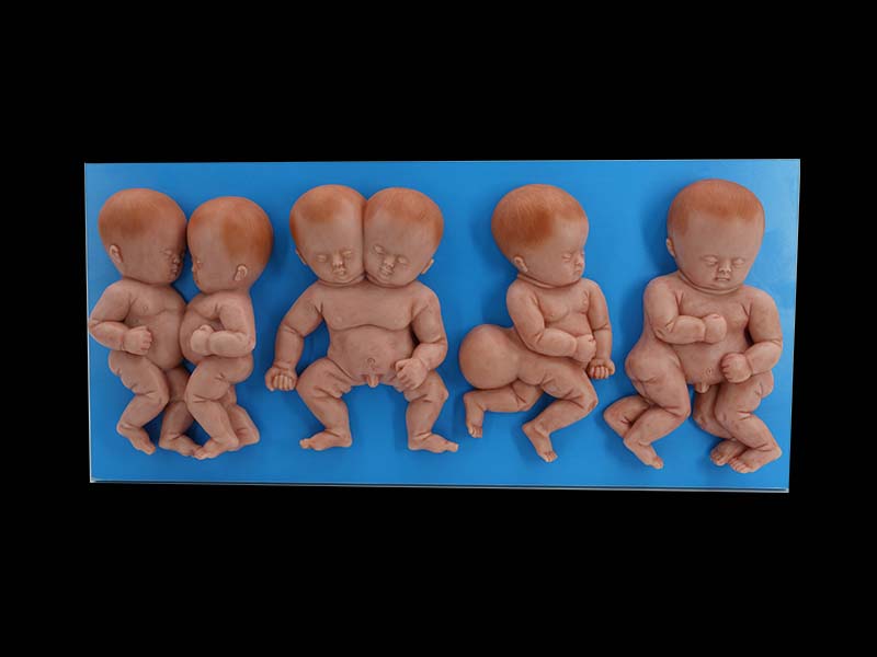 Deformed Fetus Simulation Silicone Model