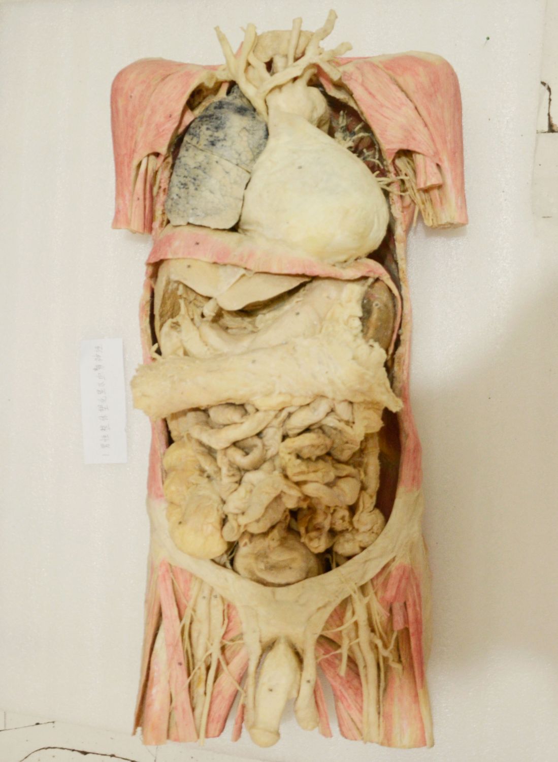 plastination torso specimen