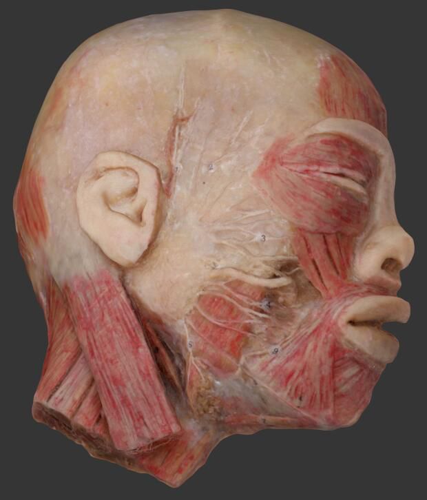 facial nerves plastinated specimen