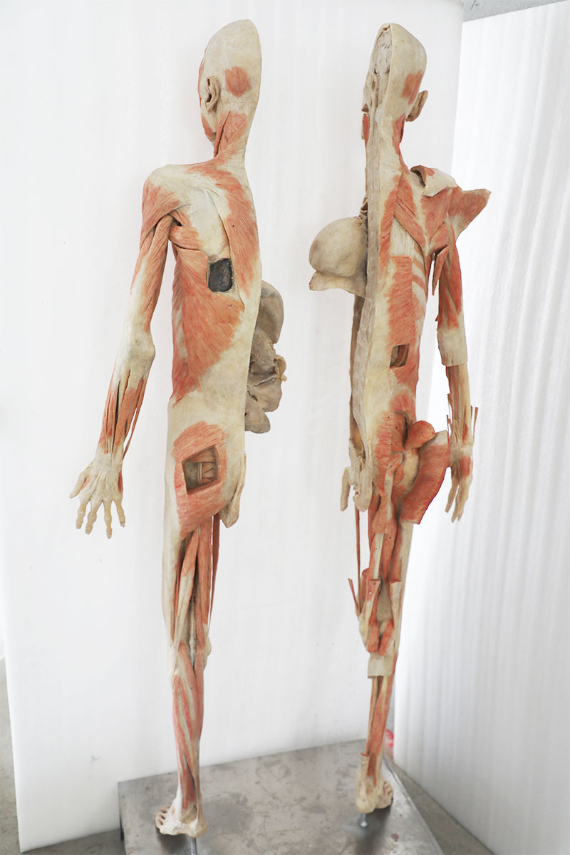 male plastinated body