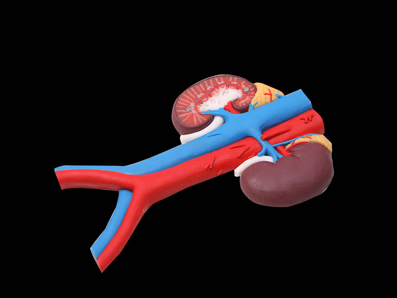 Human Renal Blood Vessels Soft Silicone Anatomy Model