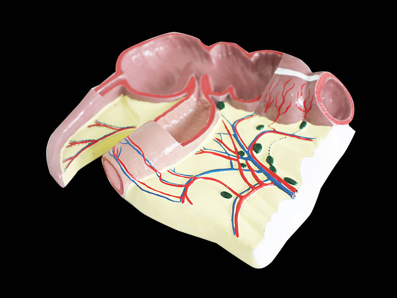 Ileocecal Junction Soft Anatomy Model