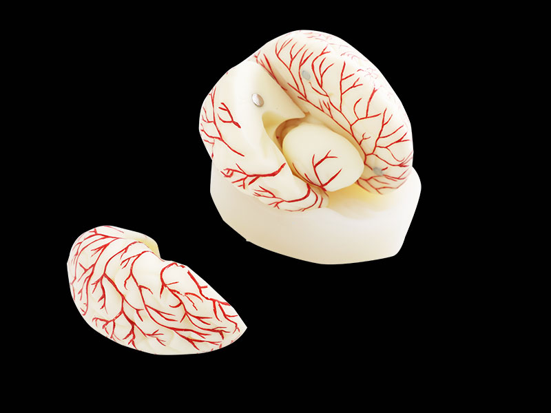 Cerebral Arterial Distribution Soft Anatomy Model