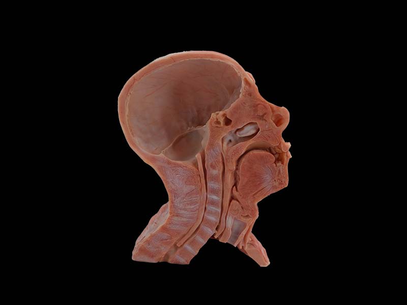 Head and Neck Blood Vessels & Muscle Model