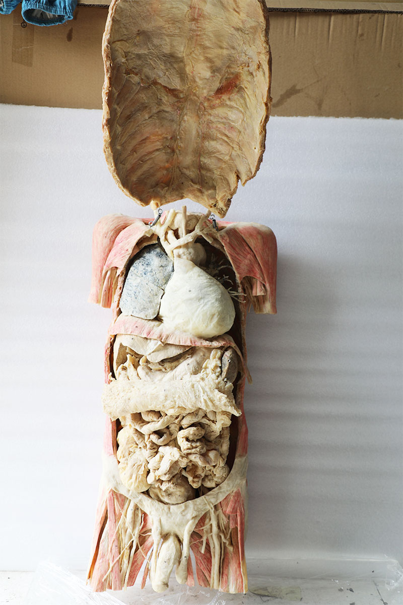 plastination torso