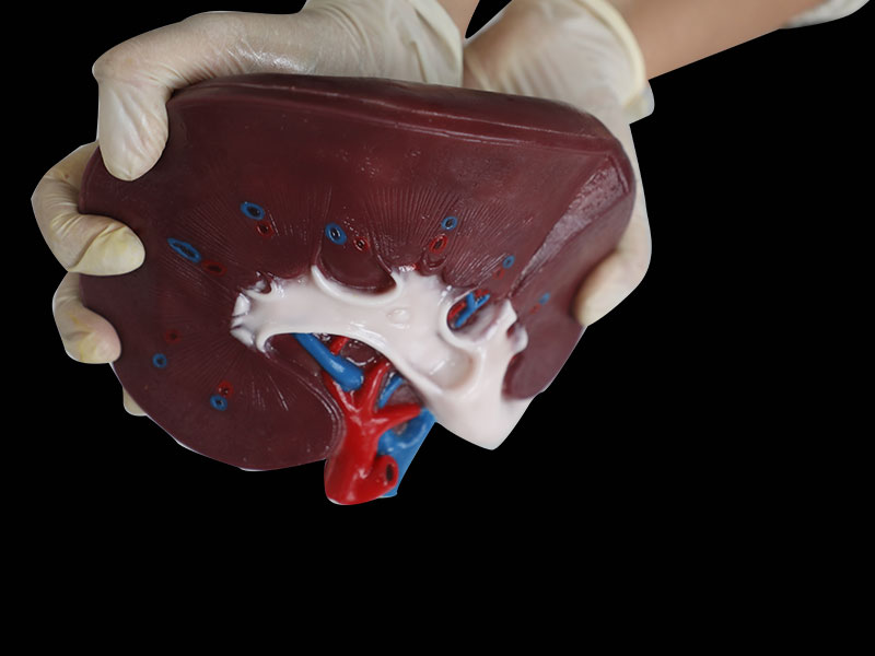 Human Section of Kidney Silicone Anatomy Model