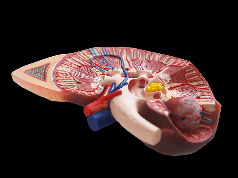 Human Kidney with Adrenal Gland Soft Silicone Anatomy Model