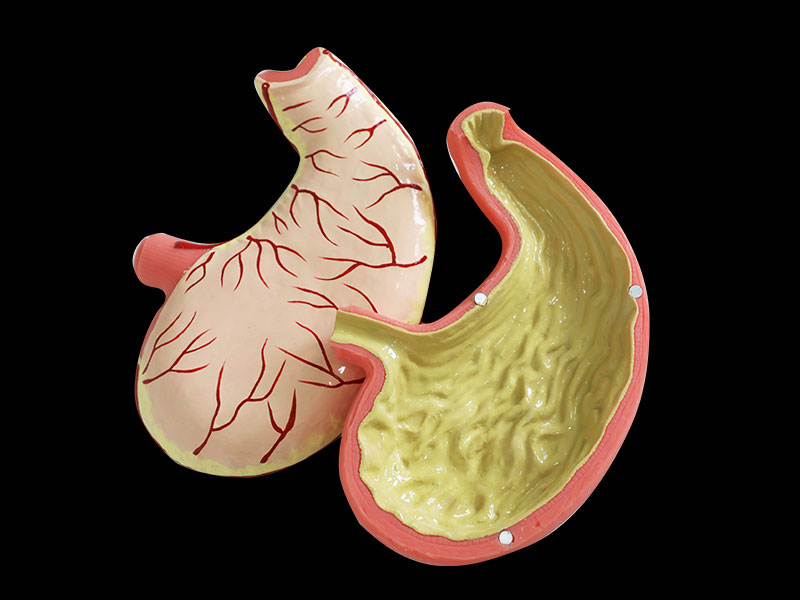 Human Stomach Muscle Silicone Anatomy Model