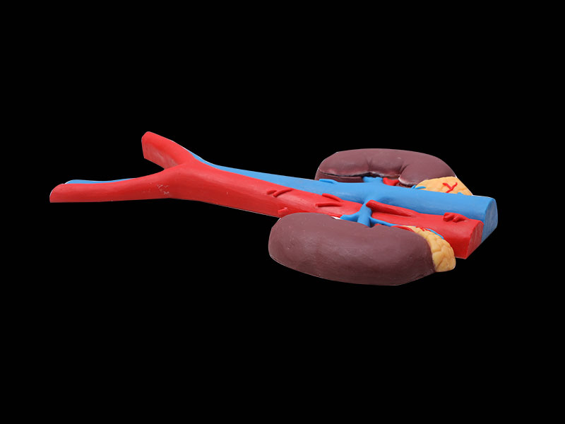 Renal Blood Vessels Soft Silicone Anatomy Model for sale