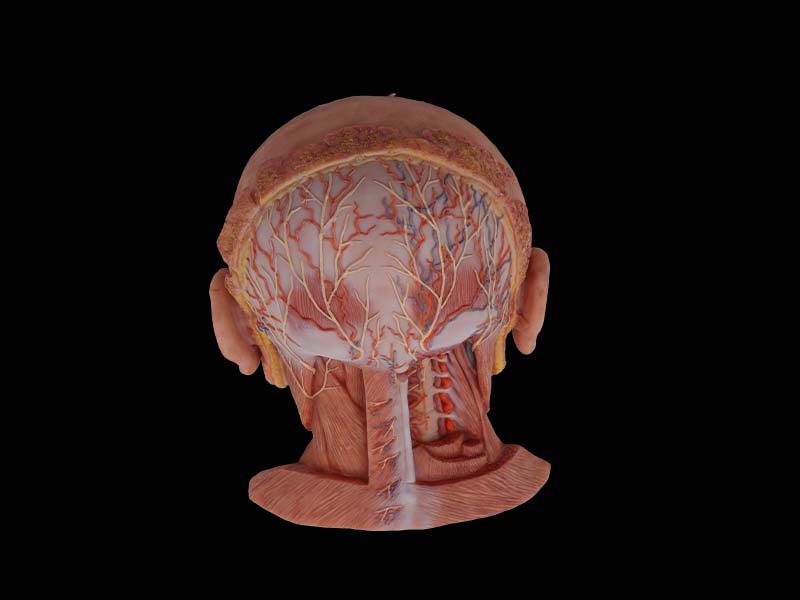 Suboccipital Triangle Anatomy Model