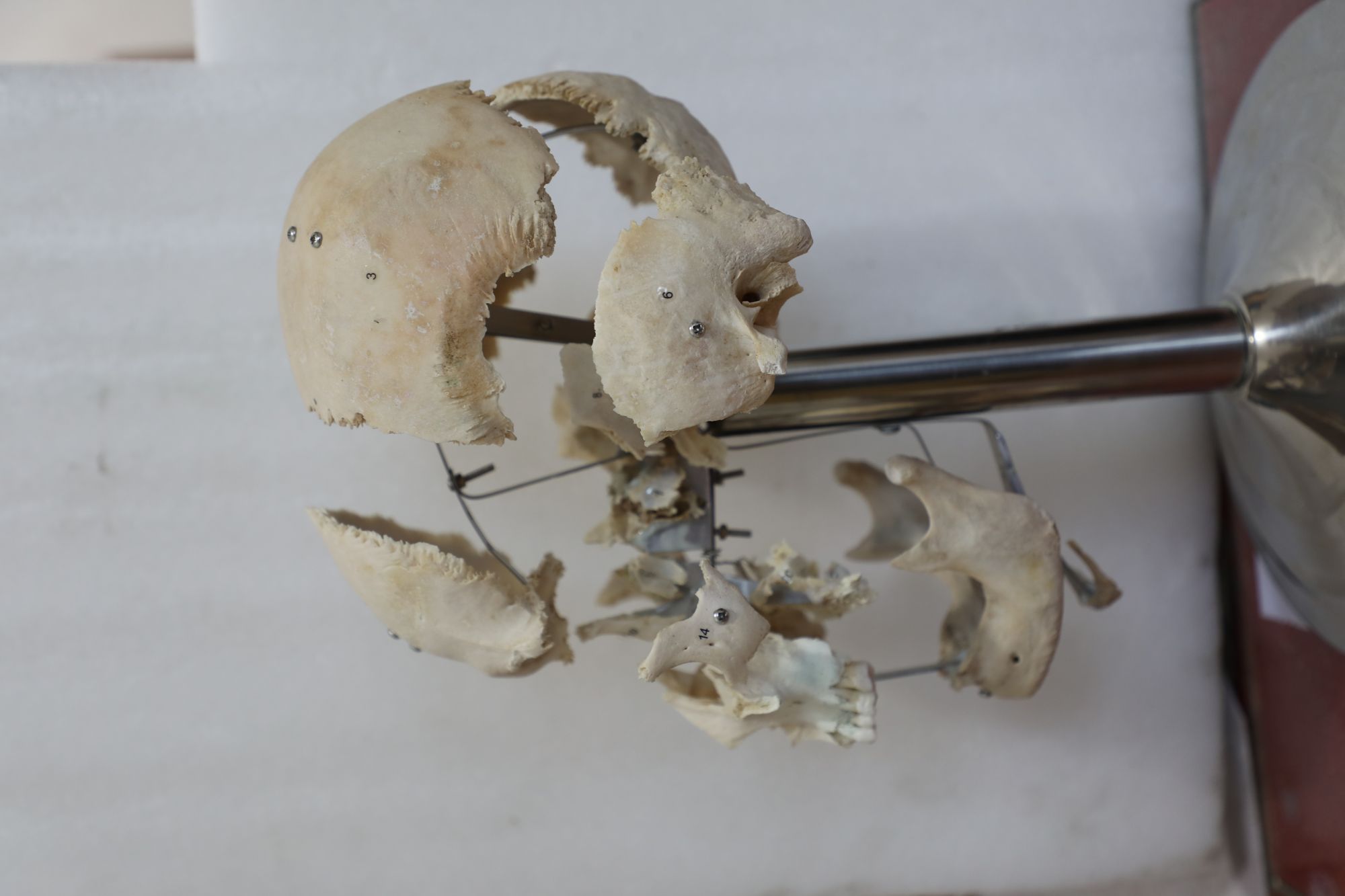 separation of human skull