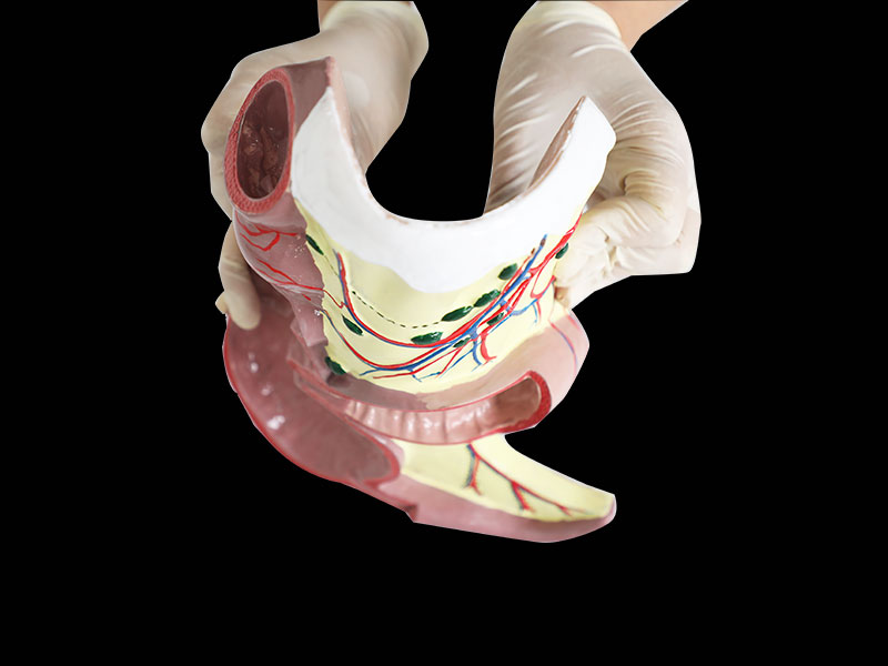 Human Ileocecal Junction Soft Anatomy Model