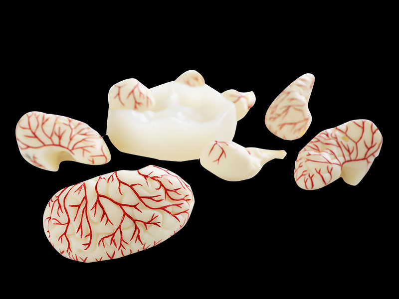 Human Cerebral Arterial Distribution Soft Anatomy Model