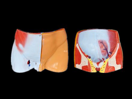 Gradation dissection model of the inguinal canal