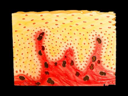 Model of Stratified squamous epithelium tissue