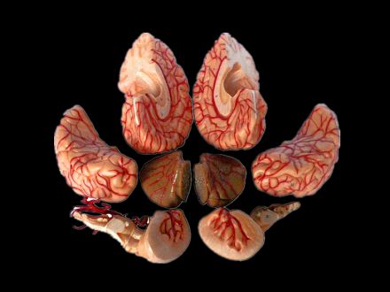brain and brain artery