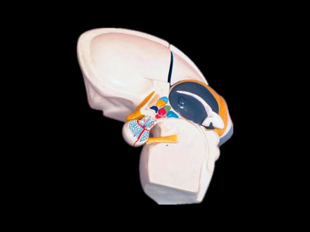 Model of diencephalon