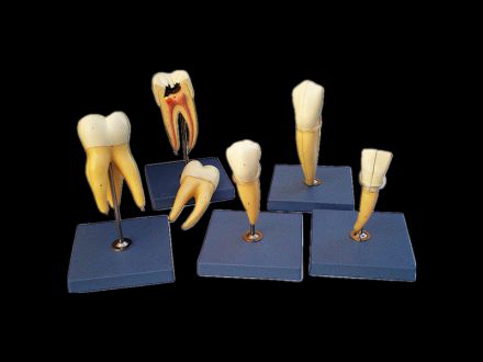 Teeth model