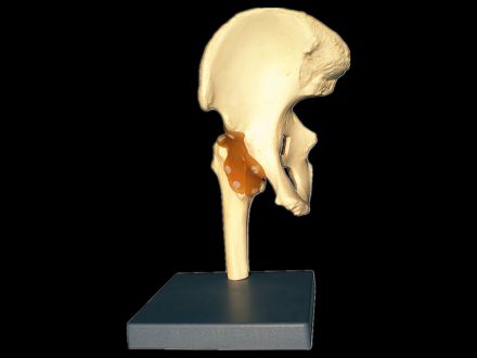 Hip joint