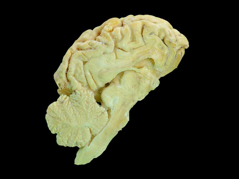 brain hemisphere of sheep plastinated specimen