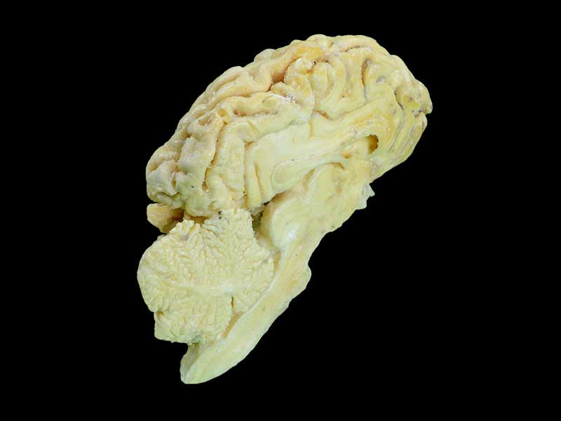 brain hemisphere of sheep plastination