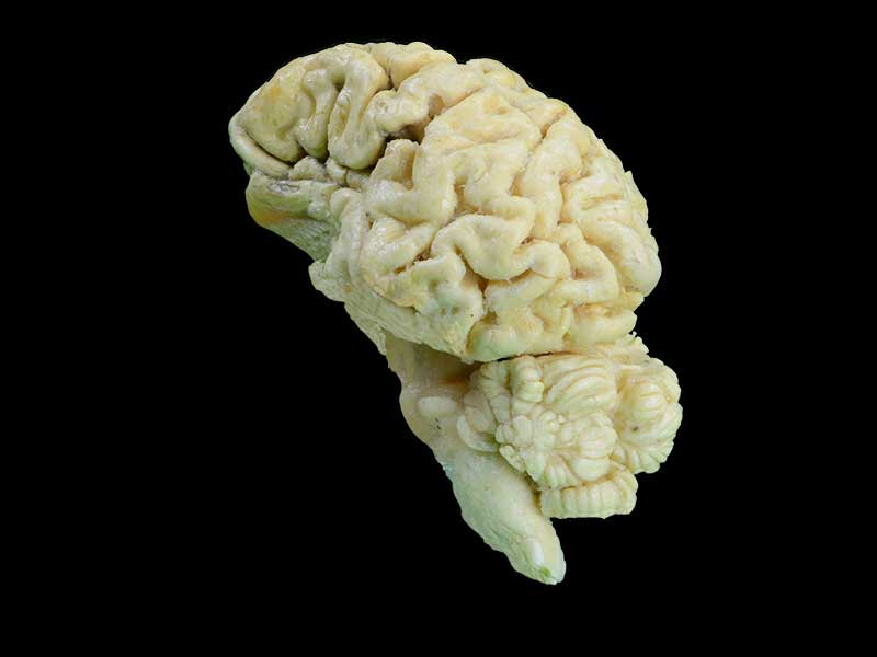 brain hemisphere of sheep