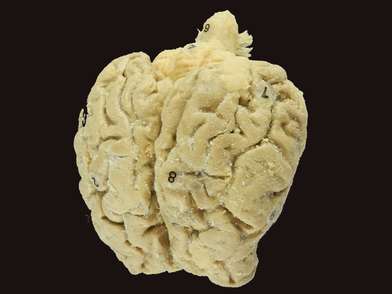 Brain of Horse plastination